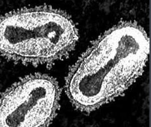 人类历史瘟疫记录,人类瘟疫灾难史