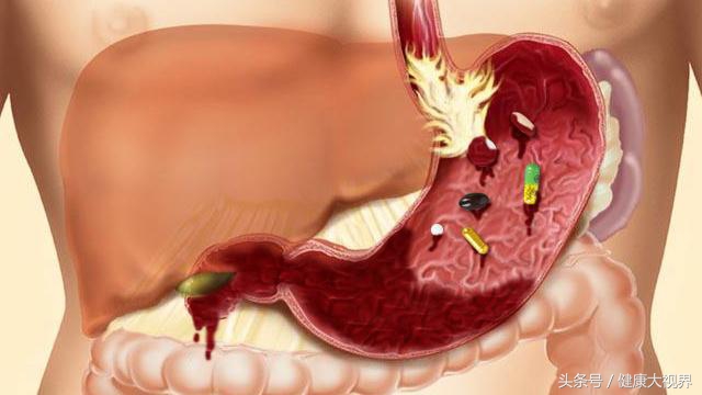 三种胃药不能同时服用,三种胃药不能乱吃的原因