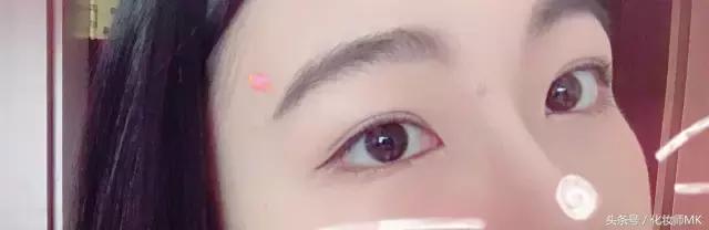 真实贴双眼皮贴,单眼皮怎么贴第二天变双眼皮