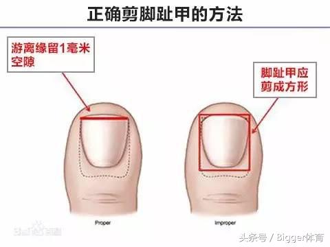 鞋带是紧的为什么会松开呢,为什么鞋带老是开着