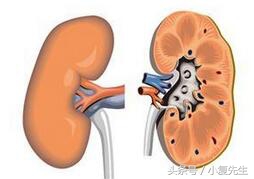 慢性肾盂肾炎中医辨证治疗,肾炎血尿中医辨证