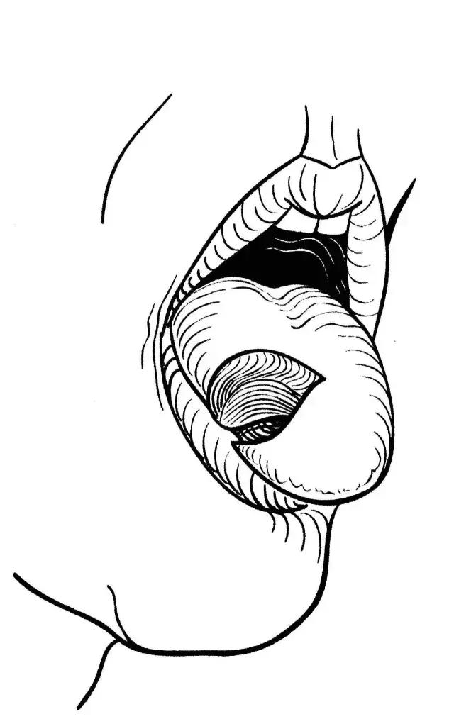 关于舌癌的新闻又一次刷屏，我想起了一年前离开的那位老人