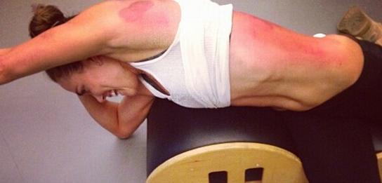 拔火罐内马尔,内马尔拔火罐视频大全