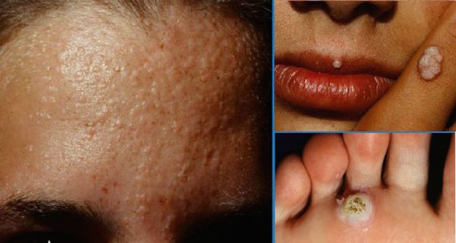 医生警惕这3种传染病,医生提醒两类人尤其要当心