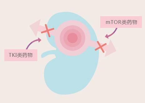 tki靶向药和抗血管生成药物的区别,tki靶向药是医保药物吗