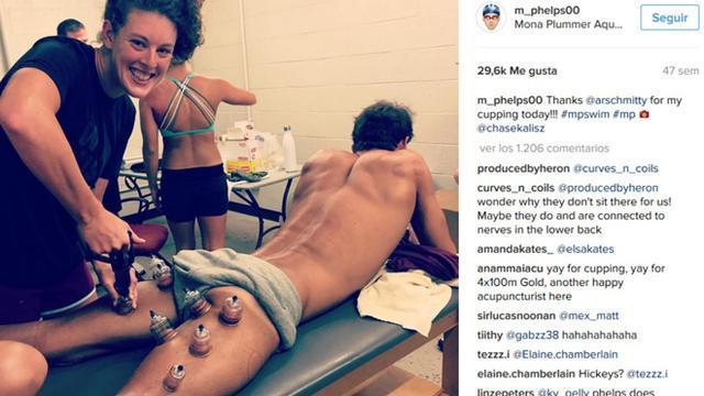 拔火罐内马尔,内马尔拔火罐视频大全