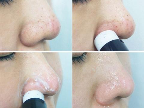 棒状护肤品风靡美国，原来除了防晒、洗脸、防汗防臭它还有这用法