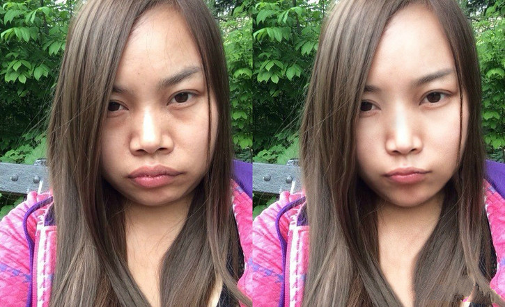 凤姐手滑点赞的东南亚整容妖术，堪比回炉再造！