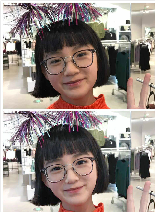 凤姐手滑点赞的东南亚整容妖术，堪比回炉再造！