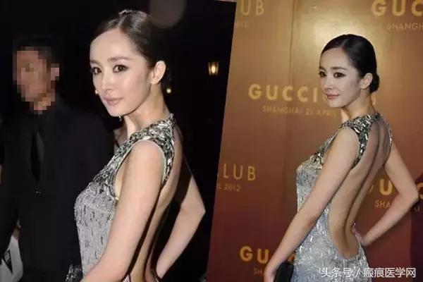 体会光的魔力，唤醒你的肌肤（很干的干货）