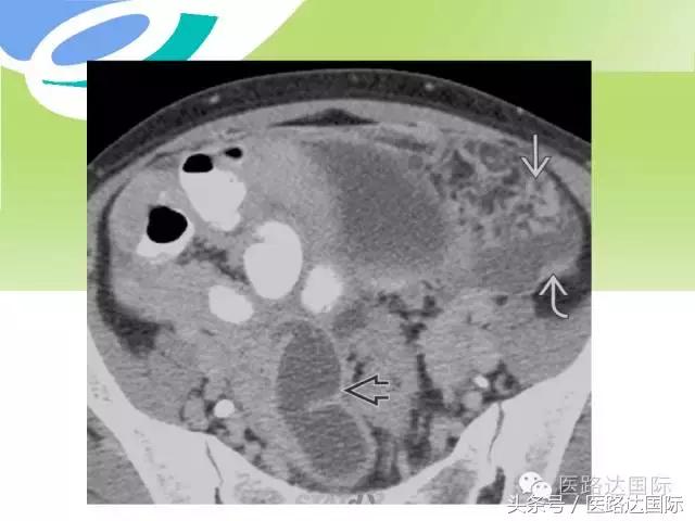 北京妇产医院梁宇霆,北京妇产医院梁宇霆出诊