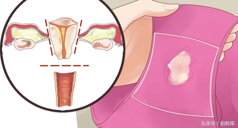 怎么判断孕妇要生,如何判定孕妇要生了