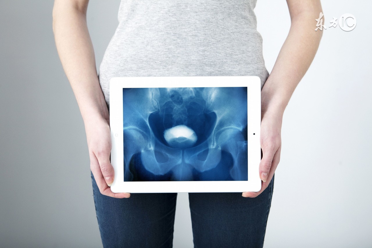 女性膀胱炎反覆发作无法根治？其实是有办法根治的