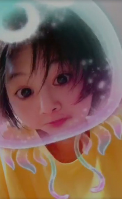 郑爽压力大深夜失眠嘴角上火，早晨起床头发凌乱不忘卖萌放飞自我