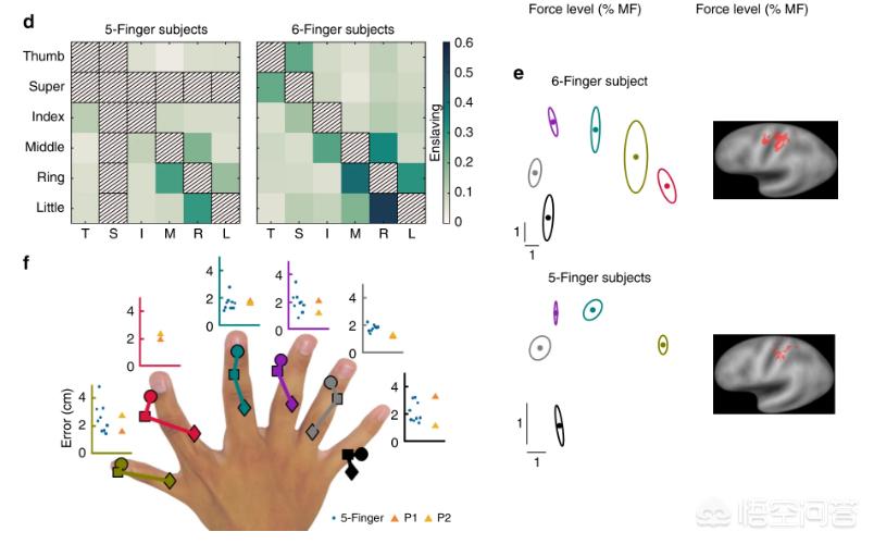 六指一般多出哪一个手指,六指多出的手指叫什么