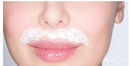 女性有唇毛怎么处理,唇毛如何去掉不再长学生党