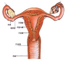关于痛经的治疗方法,关于痛经