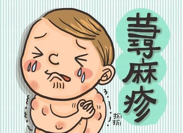 麻疹是怎样的,什么是麻疹的特征性表现