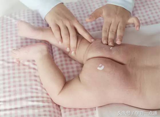 宝宝反复湿疹对付湿疹有妙招,宝宝湿疹和环境湿度