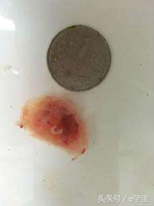 怀孕停胎流产有什么状况,怀孕停胎最初会有哪些不适