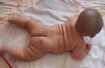 宝宝一出生脸上有一块褐色的胎记,宝宝一出生全身黑胎记