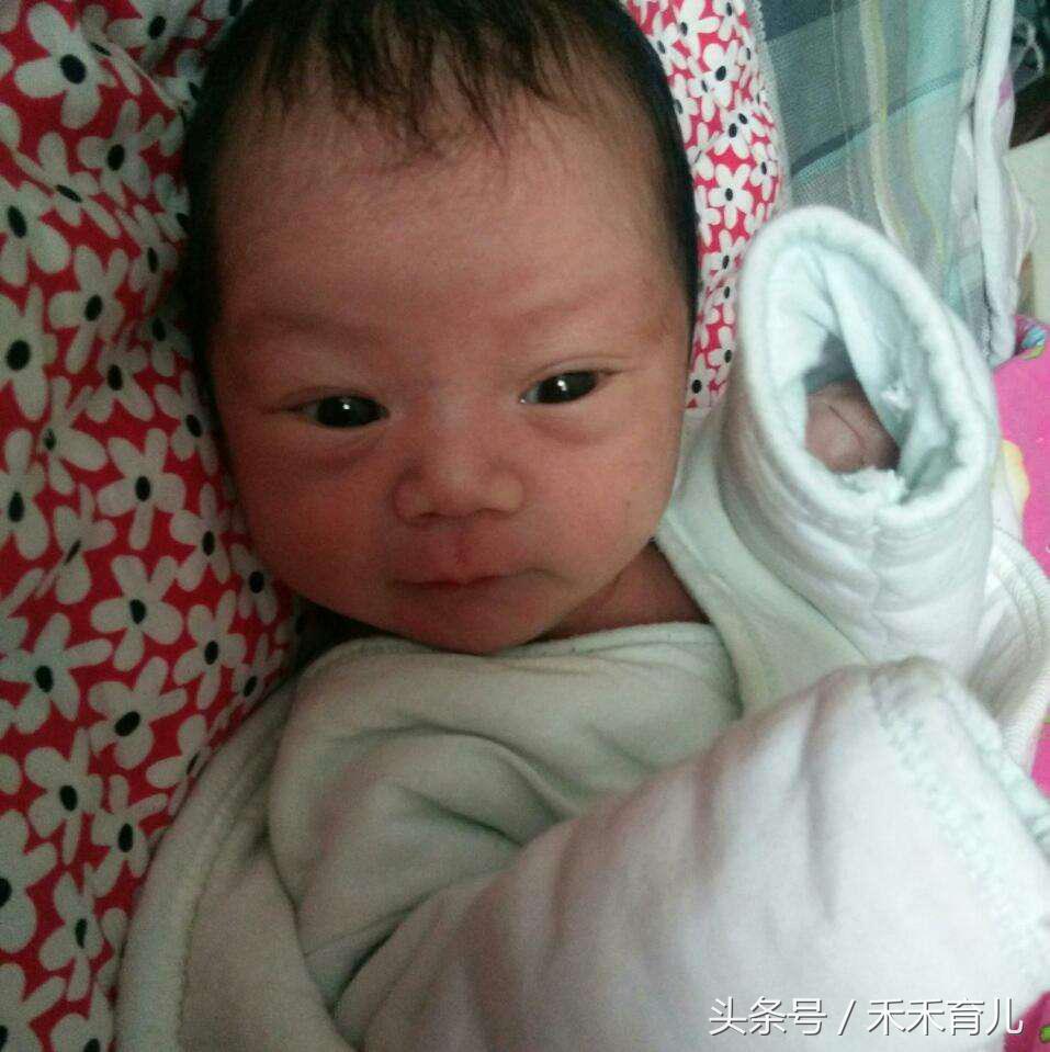 孕37周脐带绕颈2周还能绕回来么,怀孕37周胎儿脐带绕颈2周怎么纠正