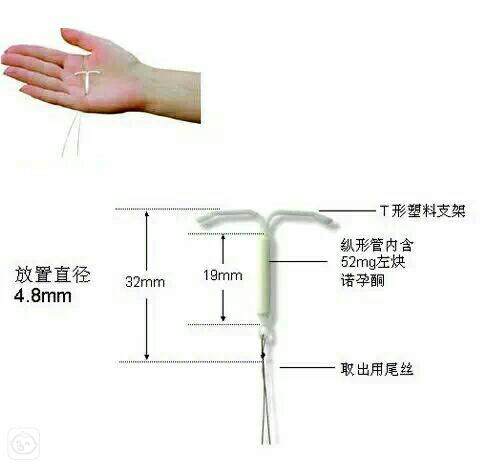 英国一宝宝握着避孕环诞生,霸气侧漏!