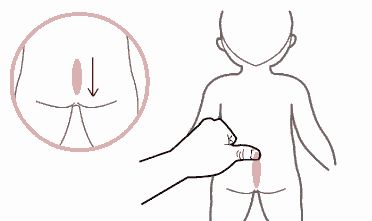 推拿便秘儿童,推拿手法治儿童便秘