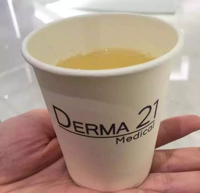 纸碗安全检测,河南省纸碗安全不安全