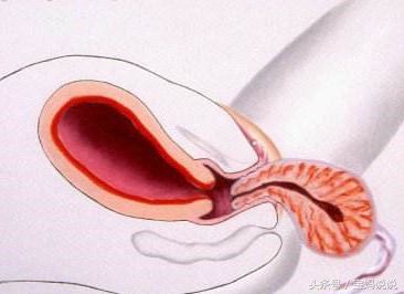 孕妈妈产检宝宝在尿床,孕妇怀孕28周睡觉尿床是怎么回事