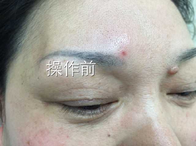 以前的老式纹眉怎么弄淡化,以前的老式纹眉不洗能再纹吗