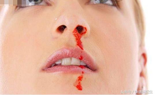 小孩子睡觉流鼻血什么原因,一岁宝宝睡觉起来流鼻血什么原因