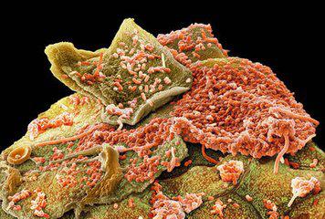 口腔里的细菌能杀菌吗,不刷牙口腔里的细菌