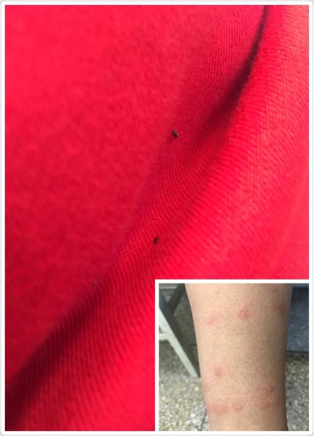 跳蚤效应小故事讲述,跳蚤的故事启示