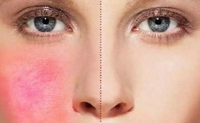 这也是皮肤一大杀手，很多人都不知道！