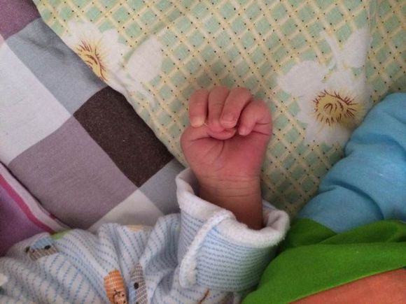 拇指内扣快速纠正的方法,一个月拇指内扣怎么矫正