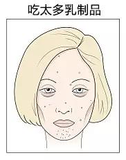 肤色不均痘印暗沉黑眼圈,长痘有法令纹真的会让人自卑