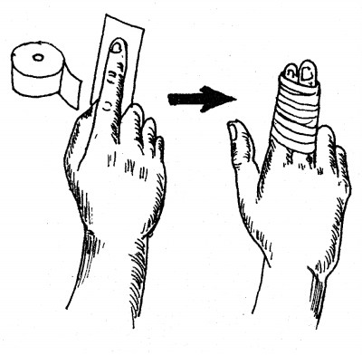 儿童意外急救小知识,儿童急救常识100个小知识