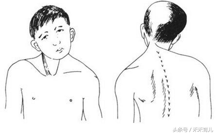 歪颈宝宝如何纠正,宝宝因为习惯导致的斜颈怎么纠正