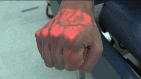 这个黑科技能照亮你的血管，让护士好好地给你扎针！