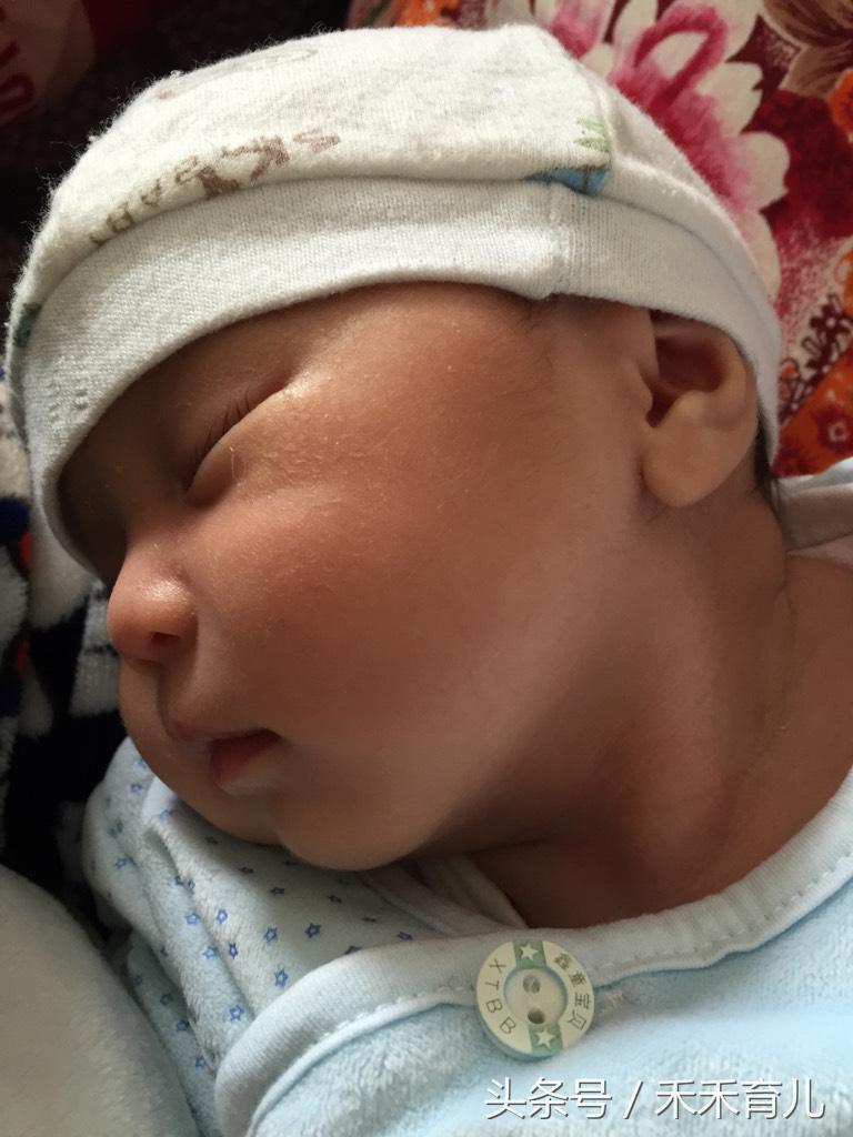 宝宝因为习惯导致的斜颈怎么纠正,大人抱姿导致宝宝斜颈