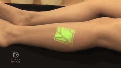 这个黑科技能照亮你的血管，让护士好好地给你扎针！