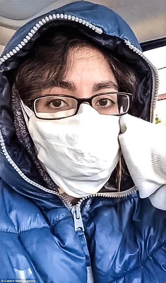 女明星对帅哥过敏,女演员得怪病