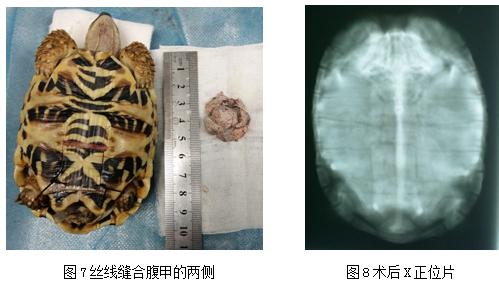 关于膀胱结石治疗方法,陆龟结石手术流程