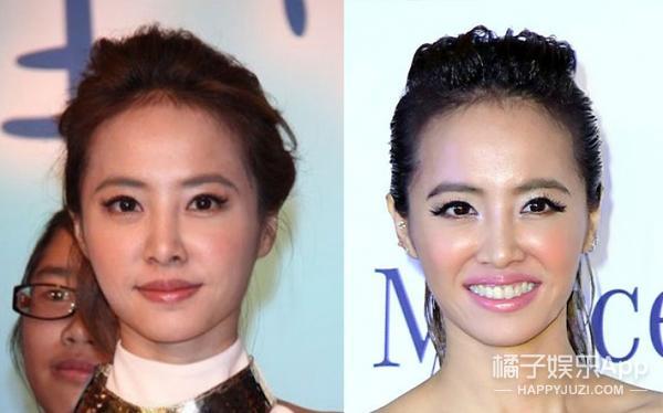 笑容引起的法令纹怎么解决,怎么样的笑容可以改善法令纹