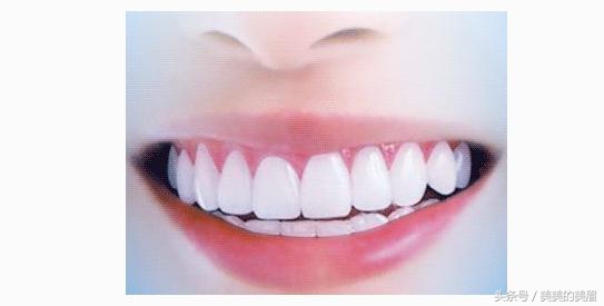 哪种牙齿美白不伤害牙齿,牙齿漂白和牙齿冷光美白