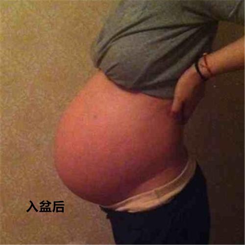 胎儿入盆会有什么表现想顺产的妈妈看这里详细入盆图解