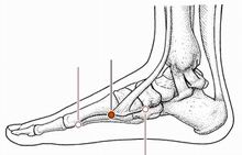 胁痛针灸,胁肋疼痛董氏针灸取穴处方