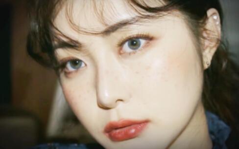 雀斑那点事：跟面部“黑斑”说再见