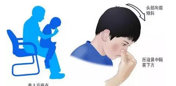 血友病，这些常见问题急需解决办法！